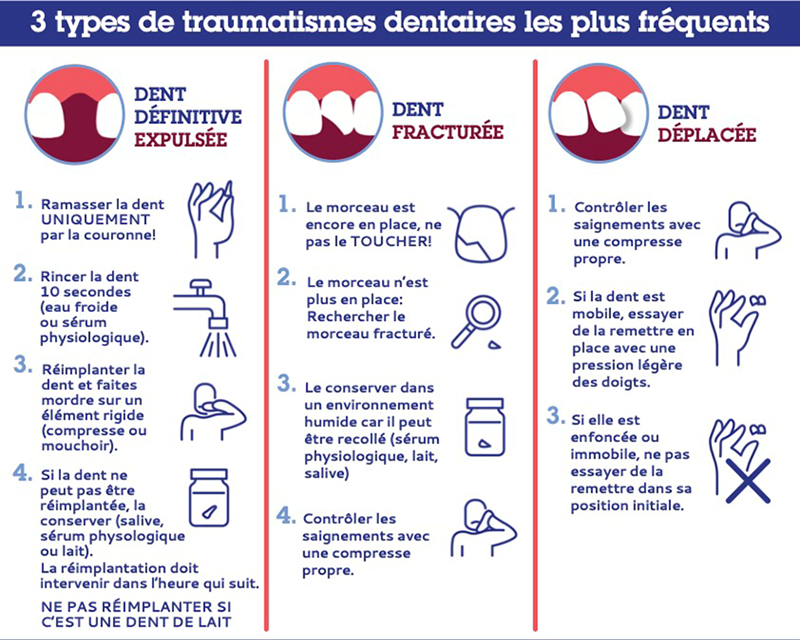 traumatisme dentaire, 3 types les plus fréquents