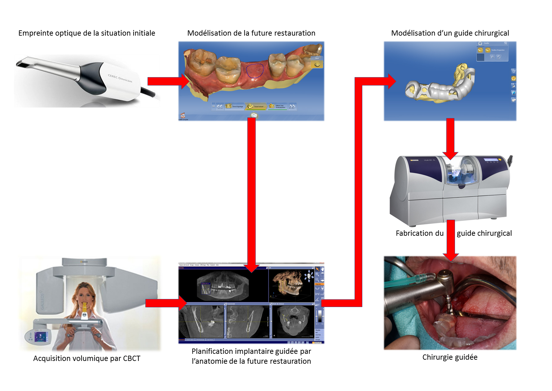 Fig. 1a : La chaîne numérique en IAO : Chirurgie implantaire.