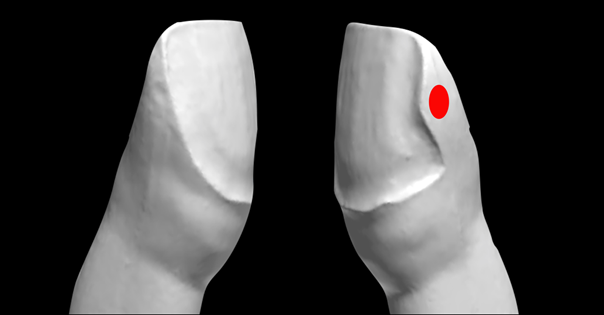A droite préparation avec toboggan (le point de contact est marqué en rouge).