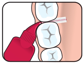 brossettes interdentaires
