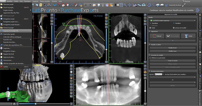 Formation-Boccara-Fichier-STL