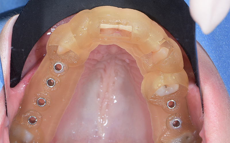 Formation-Boccara-Guide-bouche