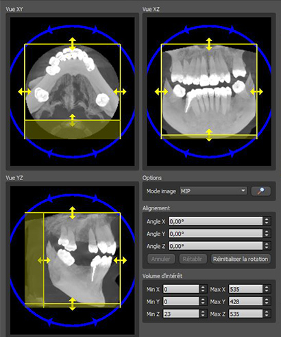 Formation-Boccara-Importation-DICOM