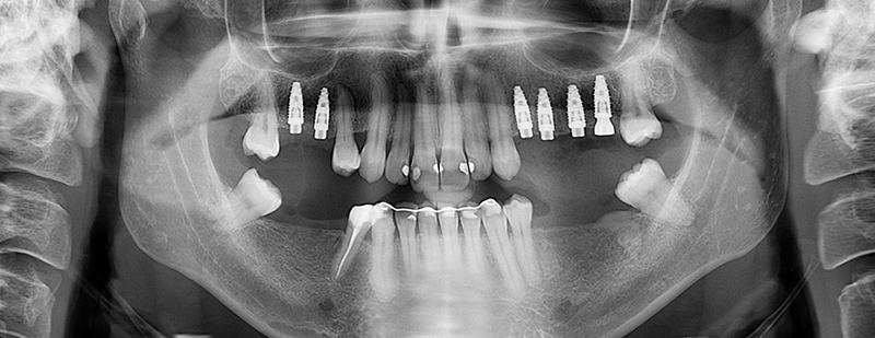 Formation-Boccara-Resultat-Panoramique