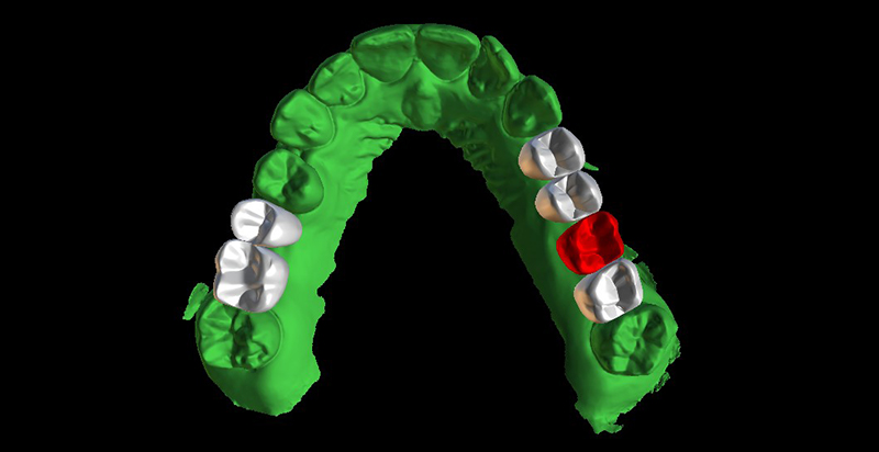 Formation-Boccara-Visuelisation-Numerique-Arcade