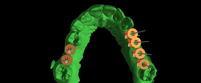 Formation-Boccara-Visuelisation-Numerique-Avec-Douilles