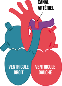 Figure3-article-cardiopathie-congenitale