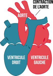 Figure5-article-cardiopathie-congenitale