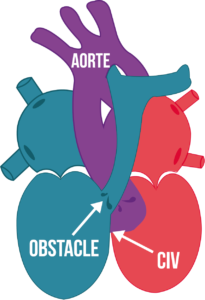 Figure6-article-cardiopathie-congenitale