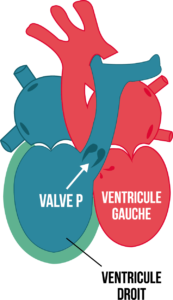 Figure8-article-cardiopathie-congenitale