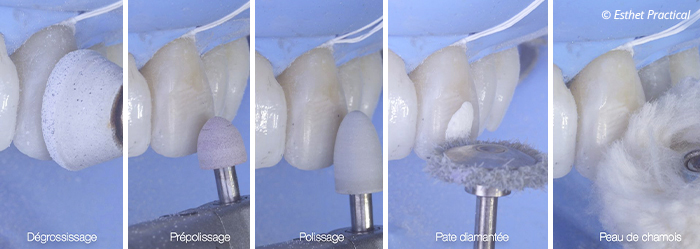 fig19-toledano-composite-stratifié