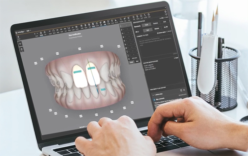 Digital - Logiciel Clincheck